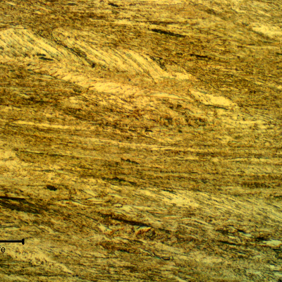 Micrographic detail of the strain hardened aged martensitic structure. Small aligned delta ferrite islands can be seen.