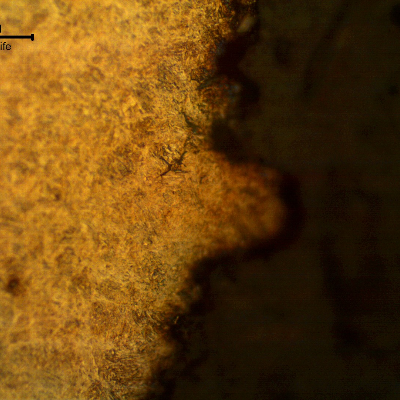 Micrographic aspect of the disc fracture (in the right side of the figure).  It is possible to see that the structure is martensitic and there are secondary intergranular cracks associated to the fracture.