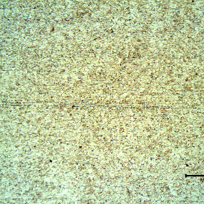 Micrography of a transverse section of the back steel of an engine bearing, presenting a predominantly ferritic structure, strain hardened.