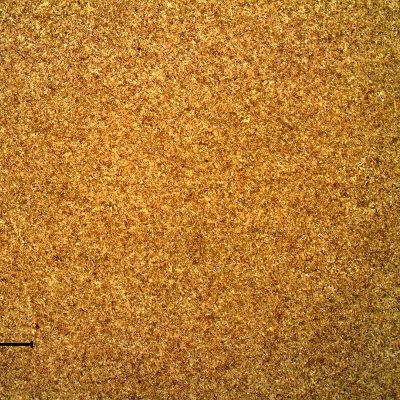 Micrography of the tool steel, in the longitudinal section of the part. The material presented a uniform structure, tempered martensite. The tempering was in low temperature since the hardness is high (58 HRc at the surface).