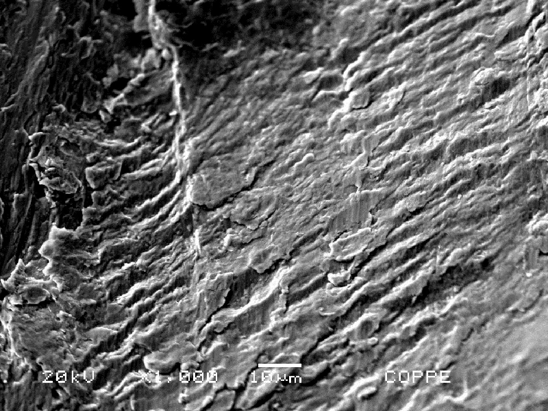 The fractographic analysis of the pin showed fatigue striation at the subcritical propagation region.