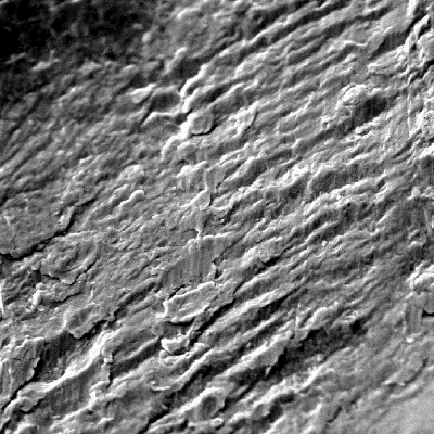 The fractographic analysis of the pin showed fatigue striation at the subcritical propagation region.