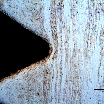 Micrography of the longitudinal section of the bolt, at the thread. The bolt was cold deformed and the thread was cold rolled.
