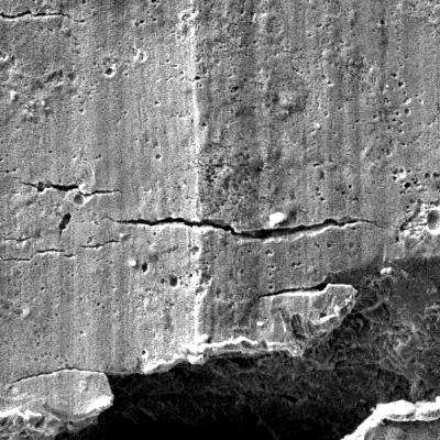 The microscopic aspect of the internal side of the housing evidences the characteristics of the multiple cracks, not directly related to pitting corrosion.