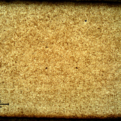 Micrography of a longitudinal section of the housing presenting a uniform tempered martensitic structure. The material presented a thickness about 2.5 mm in the region where the cracking started.