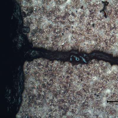 Micrography of the secondary crack, paralel to fracture, starting from the internal diameter of the padeye. The crack propagates in an interdendritic morphology, interconnecting casting defects.