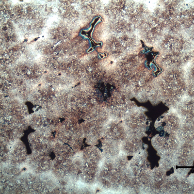 Micrography of a region where there is a large amount of casting defects. Shrinkage voids in interdendritic spaces, some interconnected and cracked.