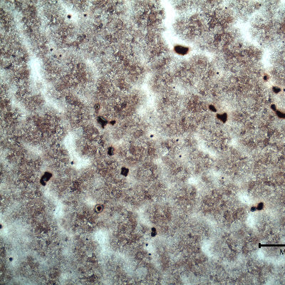 Micrography of the lifting padeye showing a dendritic path of a quenched and tempered martensitic microstructure.  The segregated regions (white interdendritic regions) are more clearly identified in low magnification. Voids are located in these segregated regions.