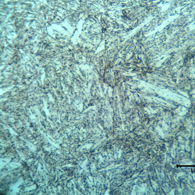 Micrography of the lifting padeye showing a quenched and tempered martensitic microstructure. The hardness level of the material is about 39 HRc.