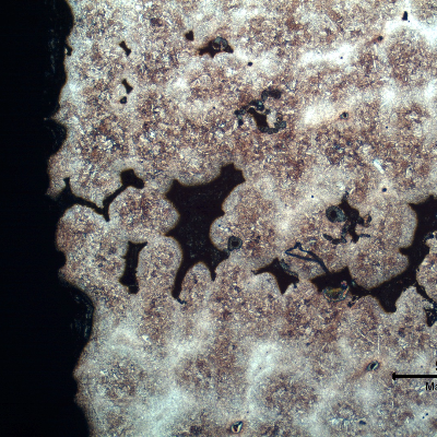 Micrography of a region where there is a large amount of casting defects. Shrinkage voids in interdendritic spaces, some interconnected and cracked.