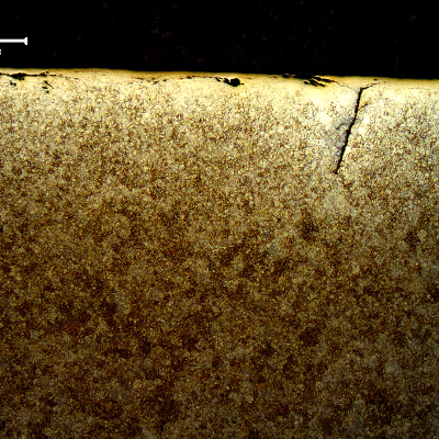Micrography of the nut in a section transverse to the surface indication. There are several microcracks (parallel and perpendicular to the nut surface) filled with oxides.  The nut presented a martensitic microstructure in the center of the thickness and a ferritic-bainitic microstructure at surface and adjacent to the defect, due to decarburization occurred during high temperature forging.