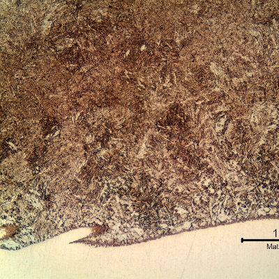 Micrography of the tubular 4130 forging at the heat affected zone (HAZ) of the Inconel overlay (white because it was not etched with the Nital). The structure is ferritic/bainitic because the overlay was conducted in two layers, and all the HAZ was reheated during welding.