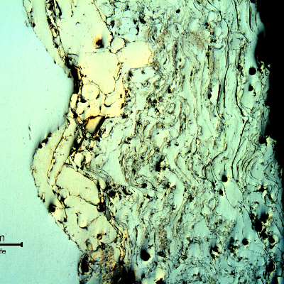 Micrography of the thermal spray (TS) layer showing the different alloys, gray oxides and black voids. 
The Ni base TS alloy is of a yellow colour at the interface with the shaft substrate (in the left).
The Cr base TS alloy appears white, similar to the shaft substrate. Longitudinal section of the shaft.