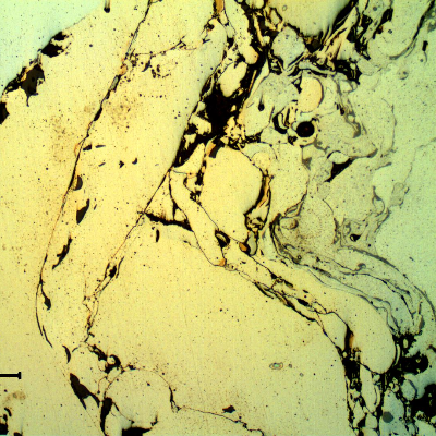 Micrographic detail, as polished in a longitudinal section, of the interface between the shaft substrate and the thermal spray layer.  In the left it is the shaft substrate also presenting parts of aligned inclusions (gray). In the center it is the Ni base TS alloy and in the right it is the Cr base TS alloy.  There are also black voids and grey oxides.