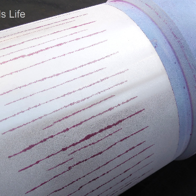 Longitudinal cracks in the surface of the pin, detected by dye check, after high pressure hydrostatic test.