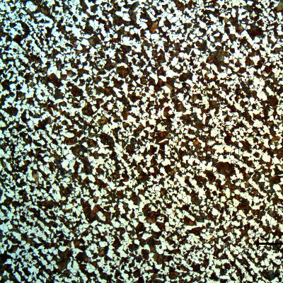 Low magnification micrography of the pin in the center of the 25 mm thickness. Ferritic-pearlitic structure of the material that slowly cooled after spray and fuse application. Transverse section.
