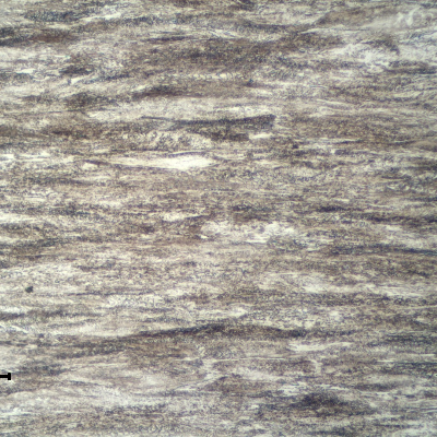 Micrographic detail of a longitudinal section of a 4 mm diameter wire, presenting an aligned and highly strained pearlitic structure. Base metal.