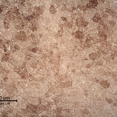 Micrography of a longitudinal section of a 4 mm diameter wire, in the center of the autogenously welded joint, presenting the alignment of the structure (left side of the figure) changing its direction due to the pressure between the parts during the welding.  In the center of the weld (right side of the figure) there is a grain growth of the previous austenite structure.