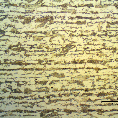 Micrography of a transverse section of the tubing, in the center of the thickness. Ferritic-pearlitic structure. The pearlite is banded and presented a coalesced aspect.