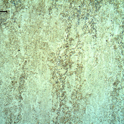 Micrography of the weld metal in the center os the weld. Columnar grains (of the previous austenite) with primary ferrite in the grain boundaries; ferrite with aligned second phases and acicular ferrite, intragranular.