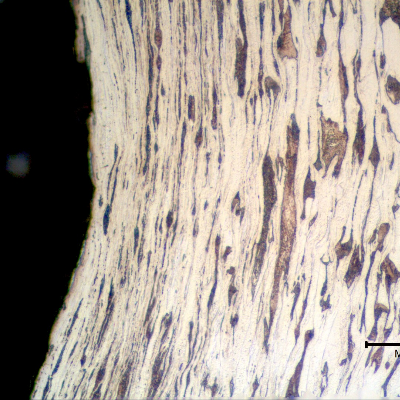 Micrographic detail of a longitudinal section of the bolt at the bottom of the thread fillet, presenting a plastically deformed ferritic pearlitic structure.  This analysis was conducted far from the failure and the structure was created by the cold forming process to manufacture the thread.