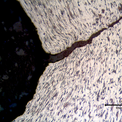 Micrography of a longitudinal section of the bolt at the thread fillet adjacent to the fracture, presenting a ductile cracking from the bottom of the fillet, propagating with a strong plastic deformation. 
The deformation lines of the cold formed process (thread cold rolling) are also deformed by the cracking propagation.