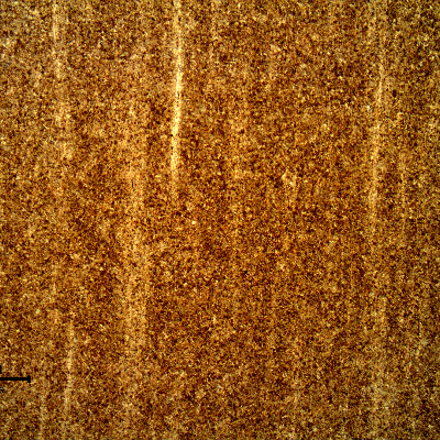 Micrography of the longitudinal section of the bolt showing a martensitic structure, with segregation bands evidenced by the chemical etch.