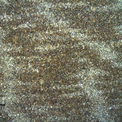 Micrography of the base metal, in low magnification, showing regions of segregations in a quenched and tempered martensitic structure.