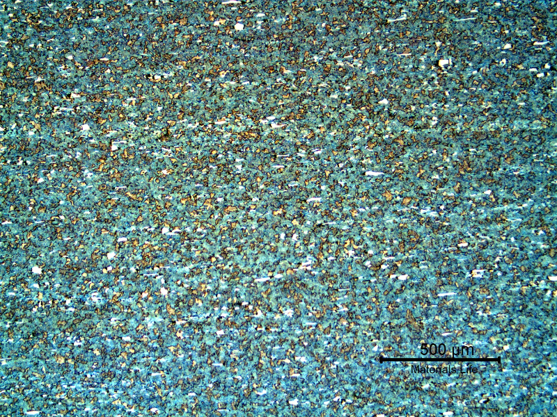 Micrography of an axial section of the roller bearing, at the internal surface, where the hardness level was about 21 HRc, indicating that in this region the material was not properly quenched and tempered.