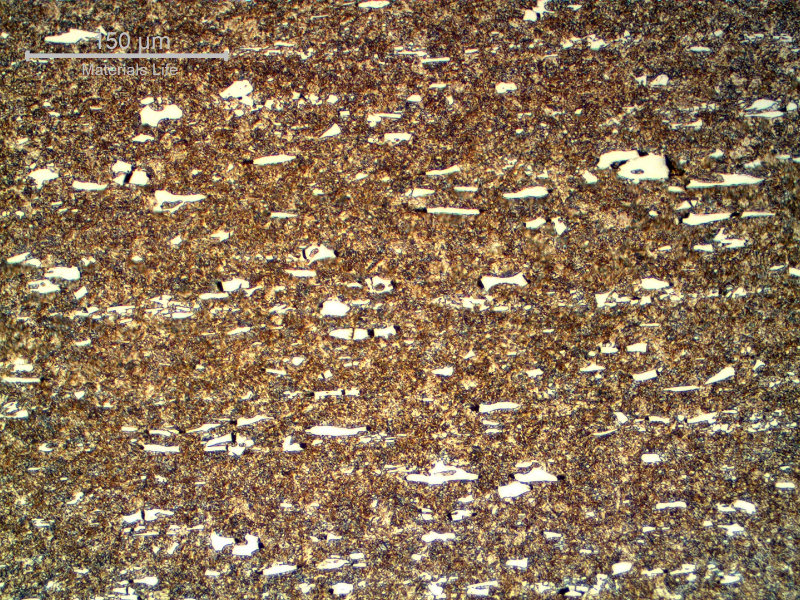Micrographic detail of the roller bearing microstructure, close to the external surface, presenting 64 HRc and a microstructure that is martensitic with large carbides.