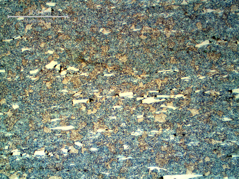 Micrographic detail of the roller bearing microstructure, close to the internal surface, presenting 21 HRc that reveals that the matrix is not martensitic. It is ferritic with large aligned carbides (cracked).
