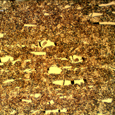 Micrographic detail of the roller bearing microstructure, close to the external surface, presenting 64 HRc and a microstructure that is martensitic with large carbides, several presenting internal cracks.