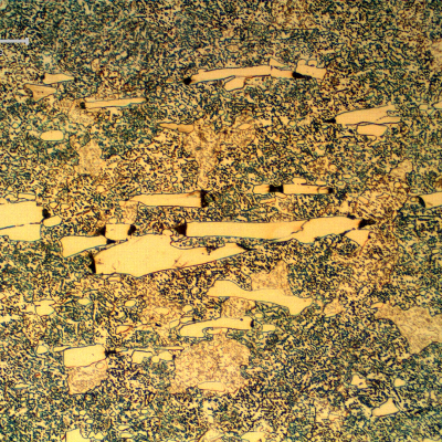 Micrographic detail of the roller bearing microstructure, close to the internal surface, presenting 21 HRc and a microstructure that is ferritic with large carbides (cracked) and small round carbides.