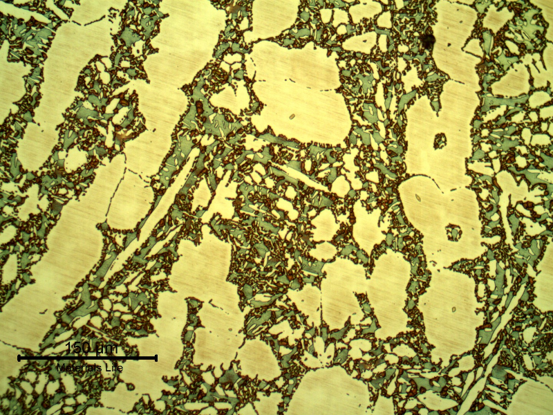 Micrographic detail of the valve body structure, close to the position where the cracking has occurred.  The structure is ferritic austenitic, with a large amount of detrimental phases associated to the ferritic structure, probably sigma phase.