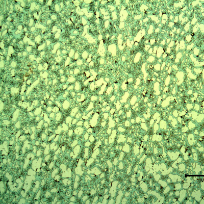 Microstructural analysis of the valve body structure, far from the position where the cracking has occurred, in the bottom of the body.  The structure is ferritic austenitic, with some sigma phase, not in a large amount, indicating the valve structure was not uniform.