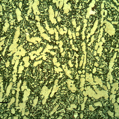 Microstructural analysis of the valve body structure, close to the position where the cracking has occurred.  The structure is ferritic austenitic, with a large amount of detrimental phases associated to the ferritic structure, probably sigma phase.