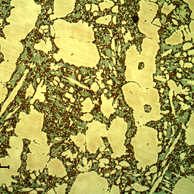 Micrographic detail of the valve body structure, close to the position where the cracking has occurred.  The structure is ferritic austenitic, with a large amount of detrimental phases associated to the ferritic structure, probably sigma phase.