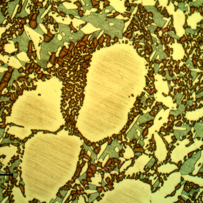 Metallographic detail of the large amount of sigma phase, associated to the ferritic structure.
