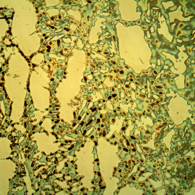 Micrography of the valve at the welded joint of the body to the insert (fillet weld). The heat affected zone shows that the sigma phase was removed, which means that the base metal was degradated and during welding the thermal cycle created a condition to remove the sigma phase (dissolve it).