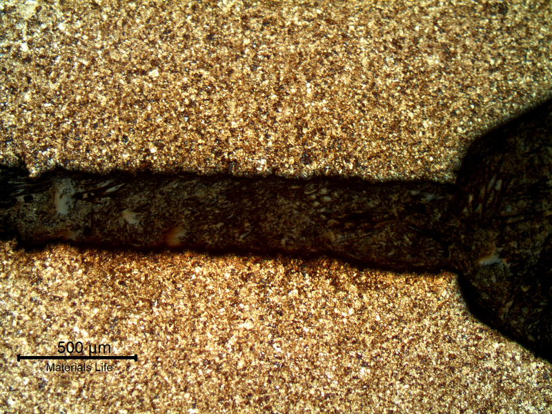 Low magnification micrography of a stud longitudinal section in the first thread fillet adjacent to the fracture, presenting a large secondary crack without any deformation evidence.  This reveals a brittle material behavior, although the hardness measured at the stud end revealed 33HRc, as should be expected by the material specification.