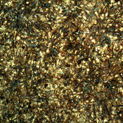 Micrography of the longitudinal section of the cylinder, in the center of the thickness, presenting large graphite flakes in a predominatly perlitic matrix.