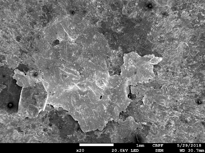 Microscopically aspect of the plate surface at the bullet impact, by scanning electron microscopy, presenting the foreign material from the bullet adhered at the surface.