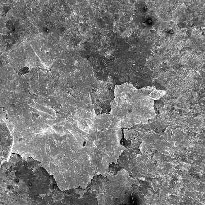 Microscopically aspect of the plate surface at the bullet impact, by scanning electron microscopy, presenting the foreign material from the bullet adhered at the surface.
