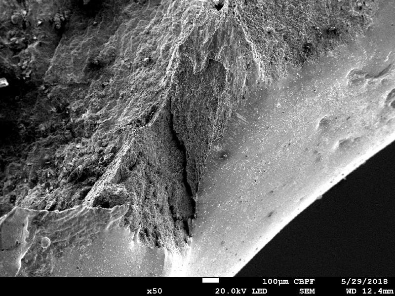 Margin of the perforated hole showing regions of fracture and a smooth appearance in the hole surface (right side of the figure). This smooth aspect was generated by the film of melted material from the bullet.