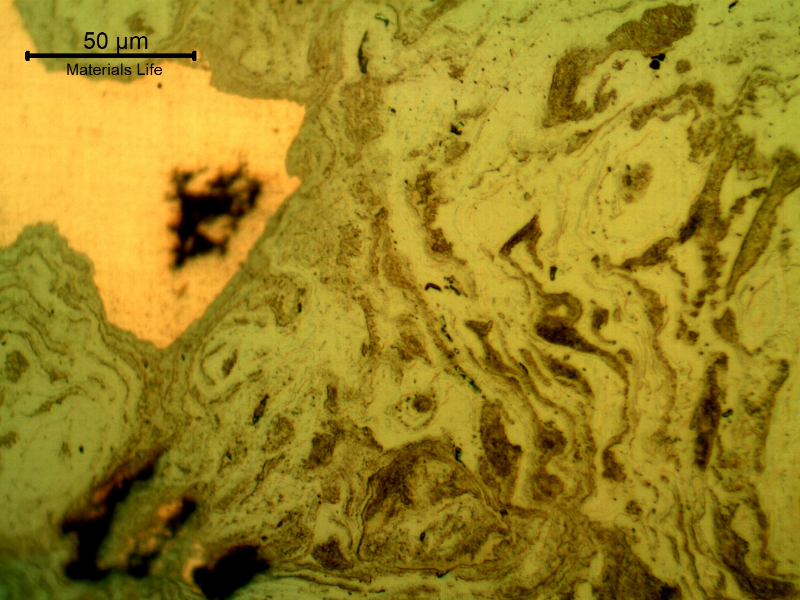 Micrographic detail of the damaged plate at the side of the bullet impact. The perforated hole expulsed the material to the top and bottom directions and the copper alloy is evident at the hole surface. There is a strong plastic deformation of the ferritic-pearlitic microstructure and the hardness level increased from 151 HV to 308 HV (1kg).