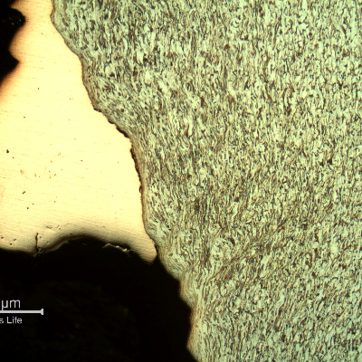 Micrography of the damaged plate inside the hole, showing the strong plastic deformation of the ferritic-pearlitic structure and the copper alloy adhered at the hole surface.
