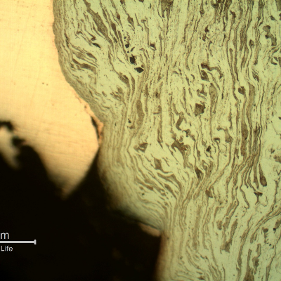 Micrographic detail of the strong plastic deformation of the ferritic-pearlitic structure and the copper alloy adhered at the hole surface.