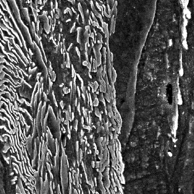 Micrographic detail of the ferritic-pearlitic structure close to the region where the projectile penetrate the plate.