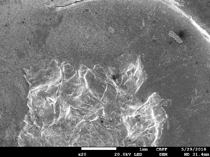 Aspect of the surface of the plate by scanning electron microscopy, at the impact position, showing that the bullet was melted and deposited. The plate presented round cracks in the margin of the projectile impact position.