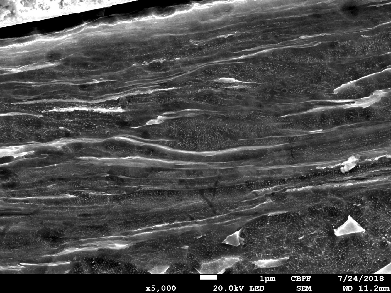 Micrographic detail by scanning electron microscopy of the plate section, close to the surface that suffered the impact. The projectile melted and created a film at the surface. The plate material presented a localized plastic deformation, aligning the grains.  HF+HNO3+H2O chemical etch.